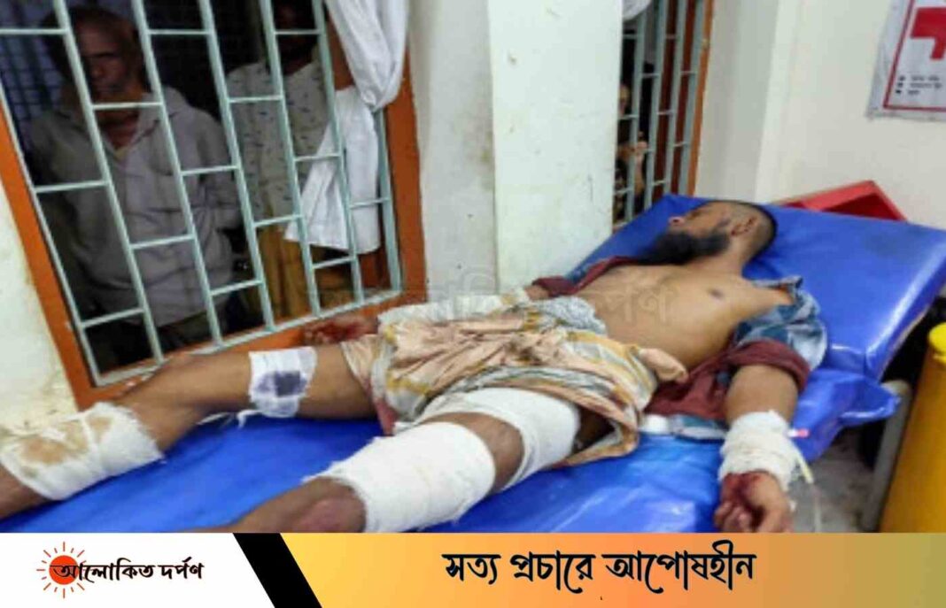 তাহিরপুরে পেন্সিল ব্যাটারী আকৃতির বোমা সাদৃশ্য বস্তু বিস্ফোরণ, আহত ৩