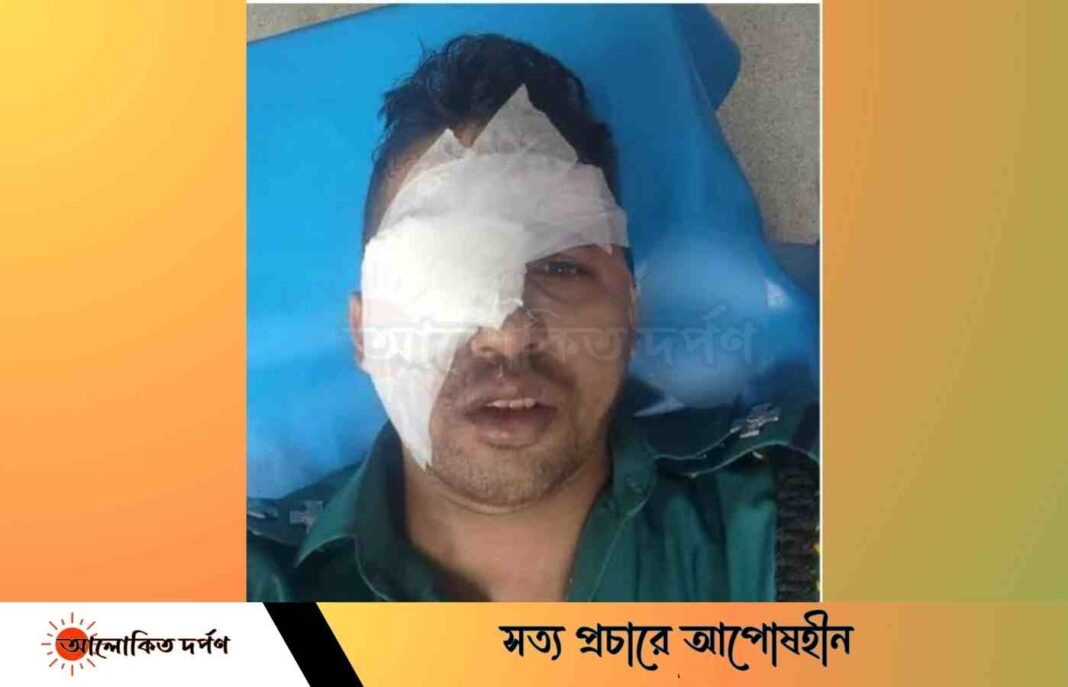 পরীবাগে হিজড়াদের হামলায় চোখ হারিয়েছে পুলিশের এসআই