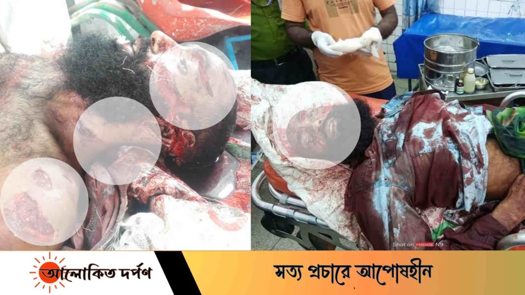 শিবপুরে কিশোর গ্যাং এর এলোপাথাড়ি কুপে একজন নিহত শিবপুরে কিশোর গ্যাং এর এলোপাথাড়ি কুপে একজন নিহত