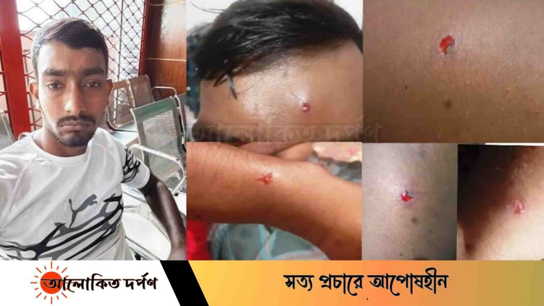 বৈষম্য বিরোধী আন্দোলনে গুলিবিদ্ধ ওমরকে বাঁচাতে সহযোগীতার আহবান