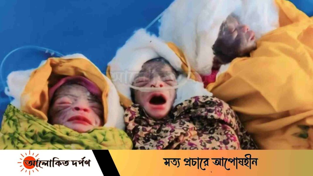 জামালপুরে একসঙ্গে তিন ছেলে সন্তানের জন্ম জামালপুরে একসঙ্গে তিন ছেলে সন্তানের জন্ম