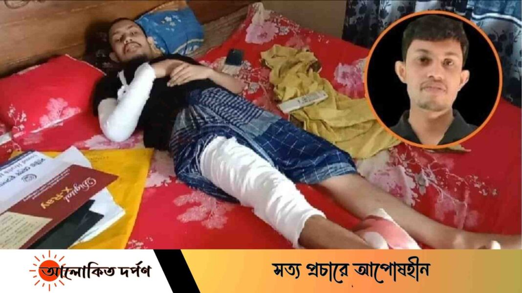 ছাত্র আন্দোলনে আহত ওয়াহেদ কাতরাচ্ছে বিছানায়, খবর নেয়নি কেউ