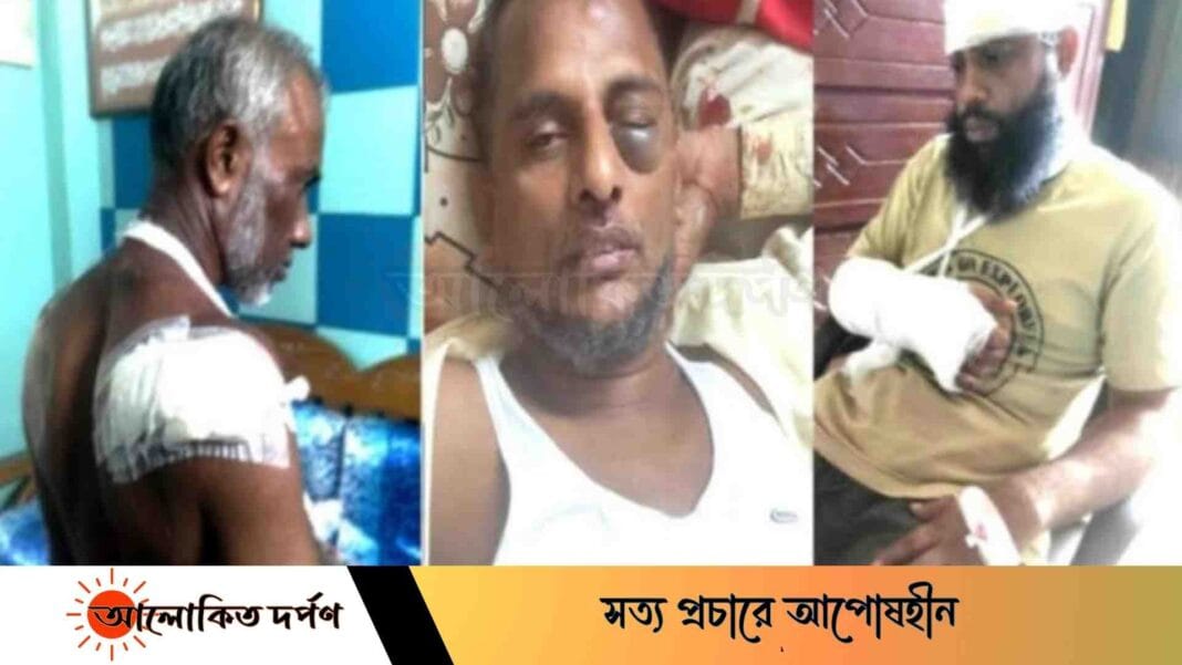 অসামাজিক কার্যকলাপে বাধা দেওয়ায় ভাড়াটিয়ার হামলার শিকার বাড়িওয়ালা