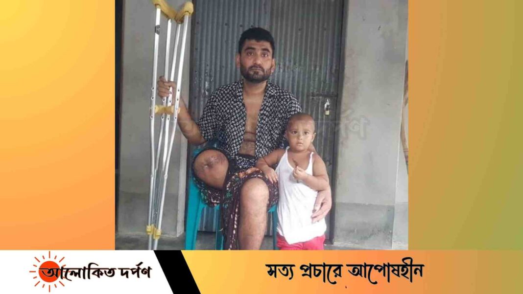 পুলিশের গুলিতে পা হারিয়ে এখন চাকুরী হারালো ইমরান 
