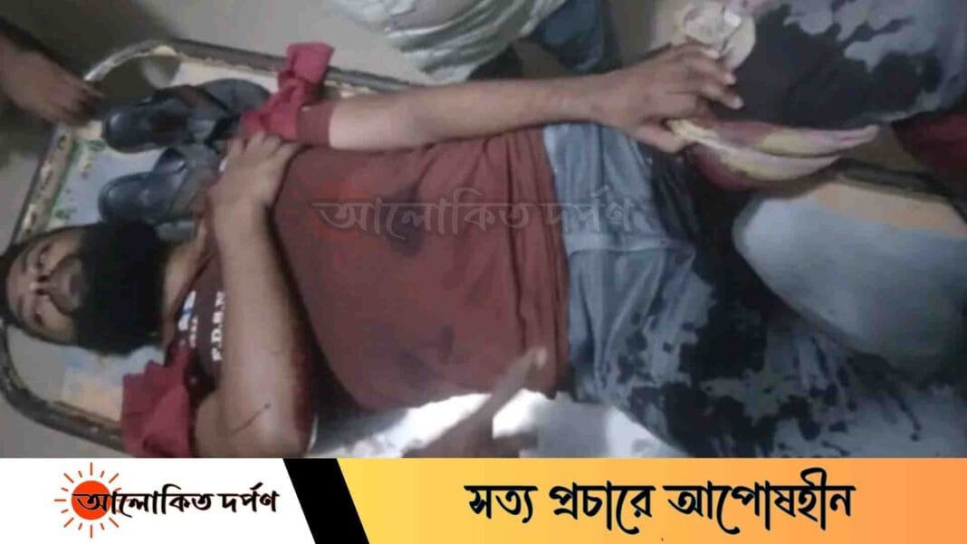 বগুড়ায় দুর্বৃত্তের ধারালো অস্ত্রের আঘাতে যুবক আহত বগুড়ায় দুর্বৃত্তের ধারালো অস্ত্রের আঘাতে যুবক আহত