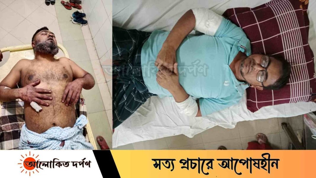 বগুড়ার শাজাহানপুরে জমি নিয়ে বিরোধে সংঘর্ষ, দুইজন গুরুতর আহত