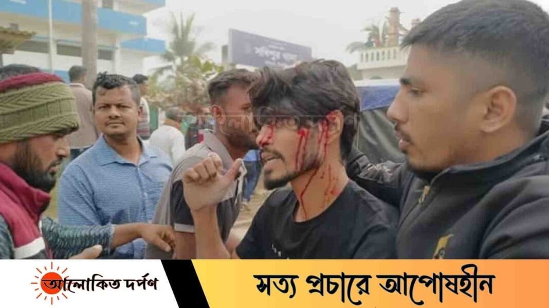 সখীপুরে বিএনপি- কৃষক শ্রমিক জনতা লীগের সংঘর্ষে আহত ৫