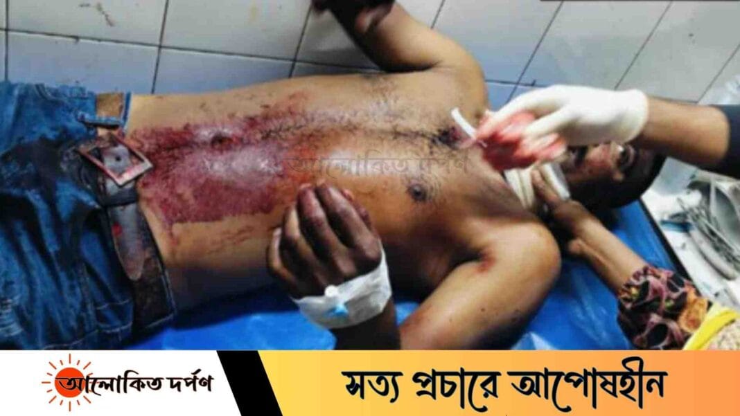 গোয়ালন্দে যুবককে কুপিয়ে গুরুতর জখম, হাসপাতালে ভর্তি