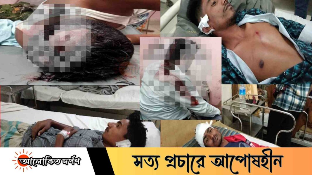 বেলকুচিতে একই পরিবারের চারজনকে কুপিয়ে আহত, থানায় মামলা