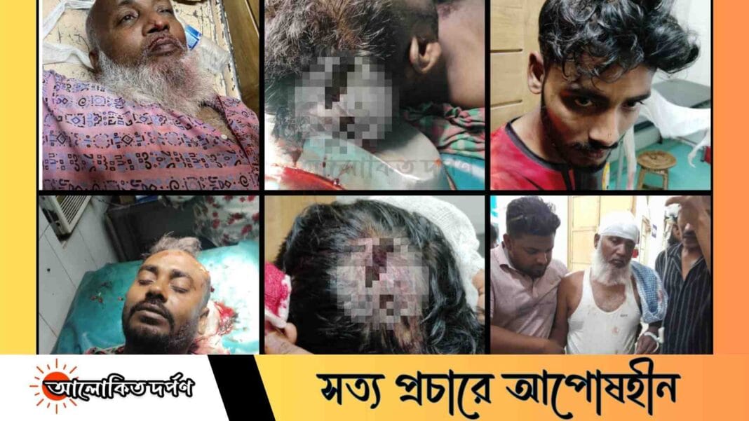 রাজশাহীতে সরকারি পুকুর দখল ও চাঁদা দাবিতে আ.লীগের সন্ত্রাসী হামলা, আহত ৫ রাজশাহীতে সরকারি পুকুর দখল ও চাঁদা দাবিতে আ.লীগের সন্ত্রাসী হামলা, আহত ৫